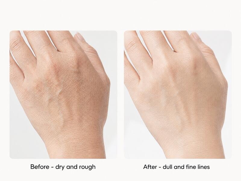 LED Hand Mask Before and After